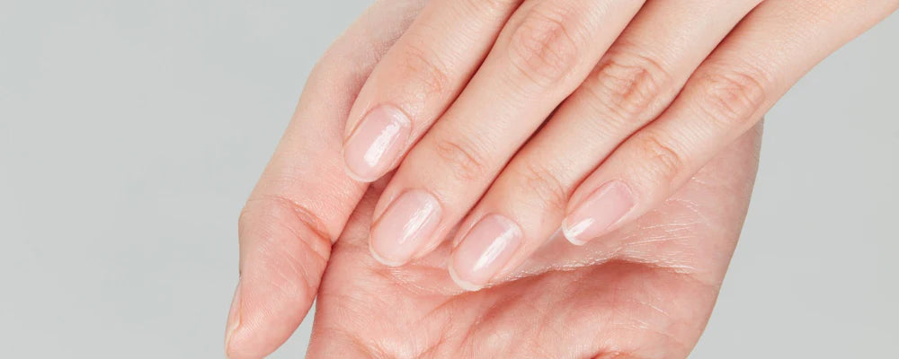 Ongles
